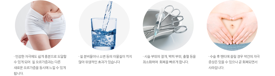 음핵성형